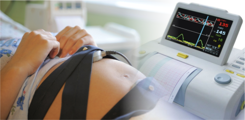 Влияет ли кардиотокография на ребенка при беременности в третьем триместре
