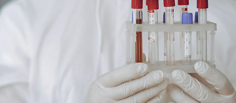 Ограничения в приеме некоторых анализов