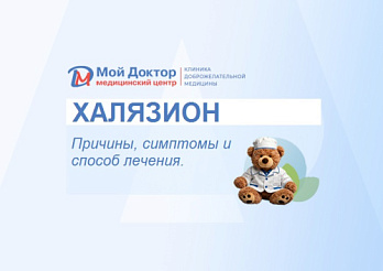 Халязион: причины, симптомы и способы лечения