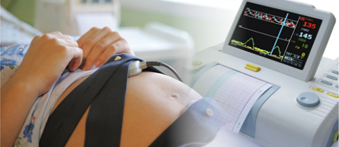 КТГ (кардиотокография)